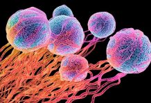 People With Cancer May Face Greater Shingles Risk.