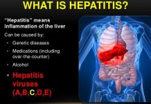 Hepatitis