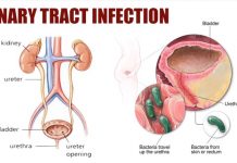 Urinary Tract Infections