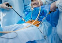 Laparoscopic Surgery