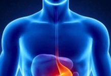 What is acid reflux !! Acid Reflux