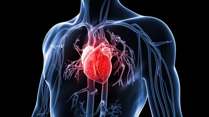 cardiact disease Heart Problem