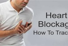 Cardiology heart blockage | healthmantra