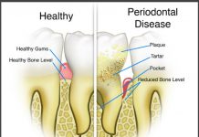 SMILE… THE SIZE MATTERS smile-the-size-matters