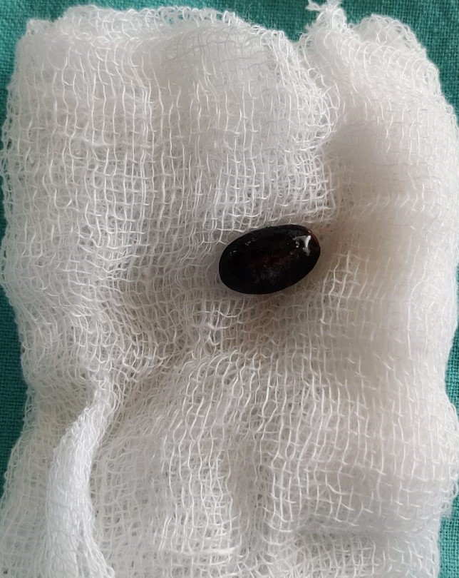 seethaphal seethaphal