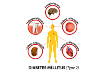 DIABETES AND ORAL HEALTH Diabetes Mellitus