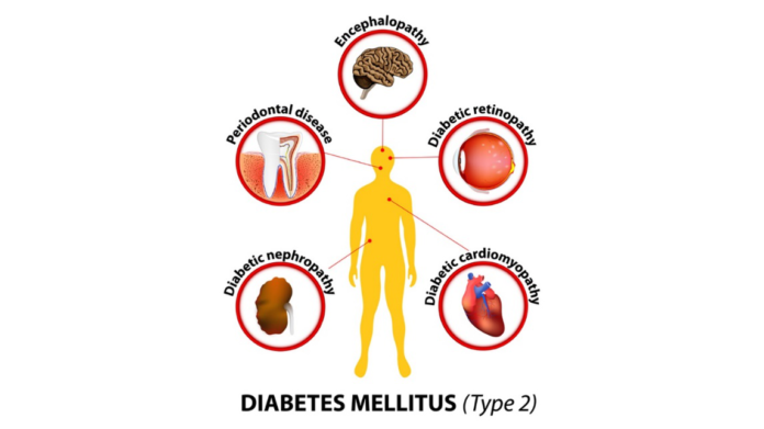Diabetes Mellitus Diabetes Mellitus