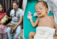 Chhattisgarh’s 1st ‘miracle baby’ survives beating odds