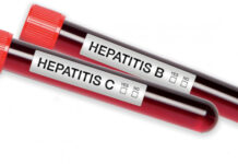 Hepatitis B & C accounts for 96% mortality of all the Hepatitis cases… hepatitis day