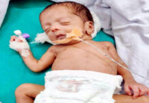 24 हफ्ते में पैदा हुआ ‘मिरेकल बेबी’ वजन 1430 ग्राम