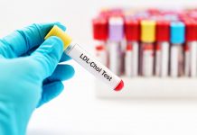 Cholesterol Screening cholestrolscreening