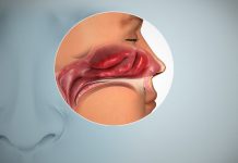 न खुशबू न स्वाद, हो सकता है एनोस्मिया के लक्षण