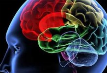 Arnold Chiari Malformation- A Rare Neurological Birth Defect ArnoldChiariMalformation