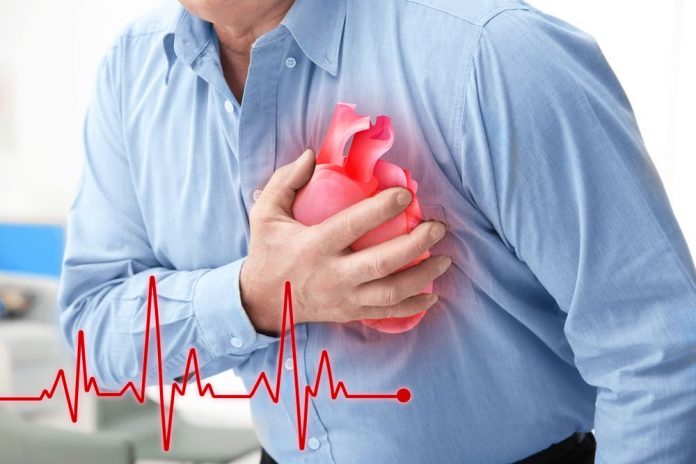 About Cardiac Issue