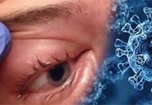 जानें क्या कोरोना संक्रमित हुए बिना भी हो सकता है ब्लैक फंगस इंफेक्शन