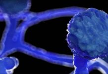 क्यों गंवानी पड़ रही हैं ब्लैक फंगल इंफेक्शन की वजह से मरीज़ों को अपनी आंखें