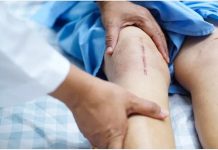 नी.रिप्लेसमेंट सर्जरी के बाद भूल कर भी ने करें लापरवाही, नहीं फिर से खराब कर सकती है स्थिति, बरतें सावधानियां