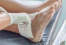 Uric Acid- यूरिक एसिड uric-acid